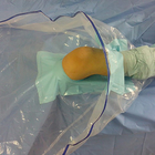 L'artroscopia chirurgica eliminabile medica del ginocchio copre il pacchetto/corredo